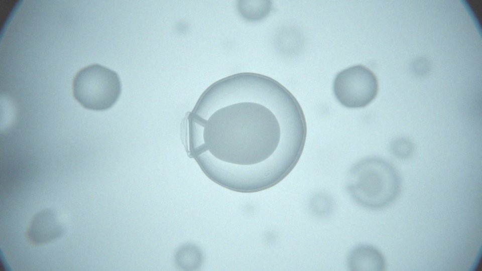 Kiedy pęcherzyk Graafa pęka i uwalnia komórkę jajową?